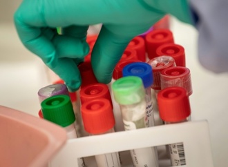 WHO hebt höchste Alarmstufe für Infektionskrankheit Mpox auf
