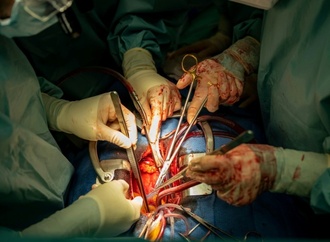 Zahl der Organspenden in Deutschland bis Oktober leicht gestiegen