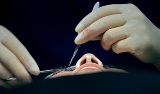 Boom von Abnehmspritzen verändert Schönheitschirurgie: Mehr Straffungseingriffe