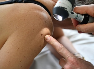 RKI: Etwa 517.800 Menschen erhielten 2023 Krebsdiagnose - Sterblichkeit rückläufig