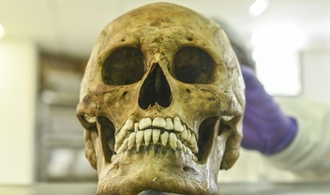 Rheinland-Pfalz: Kinder finden menschlichen Schädel in Gebüsch neben Spielplatz