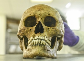 Rheinland-Pfalz: Kinder finden menschlichen Schädel in Gebüsch neben Spielplatz