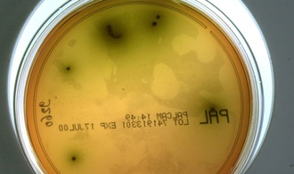 Rückruf von Lebensmitteln: Listerien sind häufigste Ursache