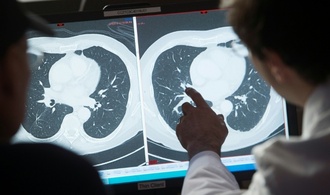 Studie: Individuelle Alterung hat Einfluss auf Krebsrisiko